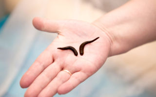 Hirudotherapy: οφέλη και βλάβες, ενδείξεις, αντενδείξεις, σχόλια