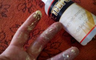 Πώς να σκουπίσετε τον αφρό από τα χέρια σας