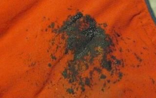 Πώς να αφαιρέσετε την κηλίδα πίσσας