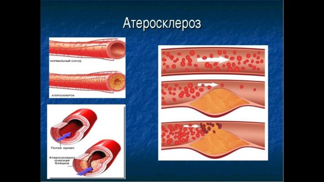 recommendations for the use of cardiomagnyl